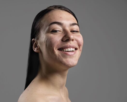 护理年轻女子对自己的粉刺充满自信的画像皮肤青春期毛孔
