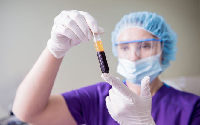 医学富血小板血浆制备管手里拿着等离子血液生物化学设备