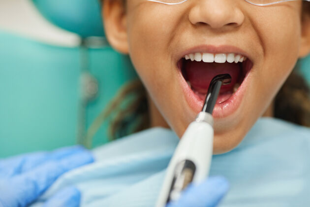 就诊小女孩张开嘴的特写镜头 牙医正在用医疗设备给她治牙举行儿童牙科