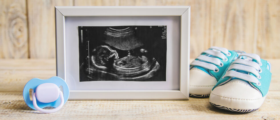 胎儿宝宝的超声波照片和配件医学未出生母亲