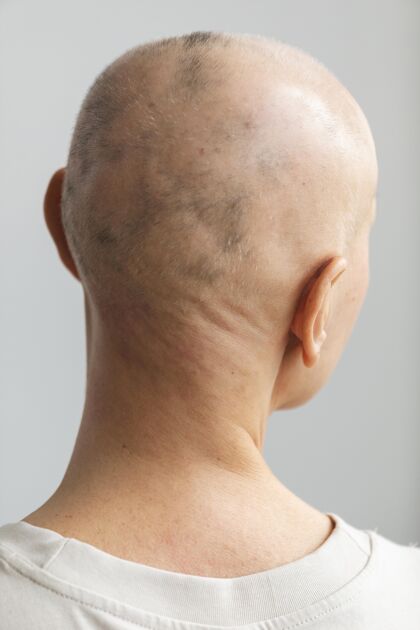 医疗皮肤癌的女人女人护理疾病