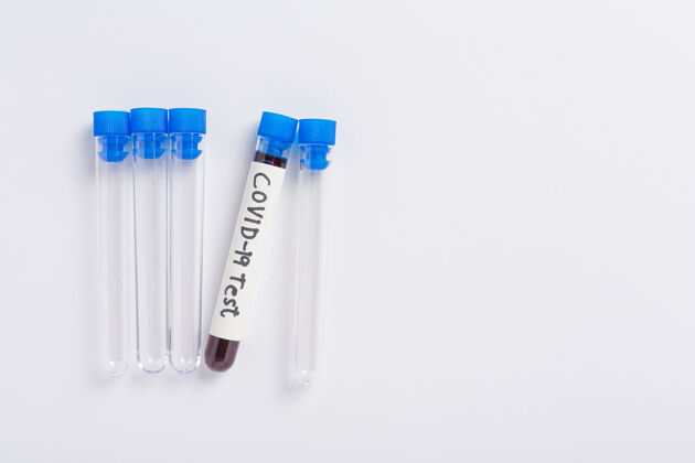 预防带血样的试管用于covid-19测试治疗传播分析