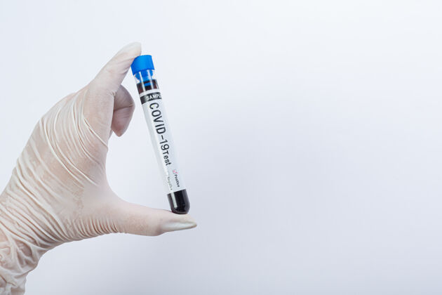 流行病带血样的试管用于covid-19测试临床预防分析