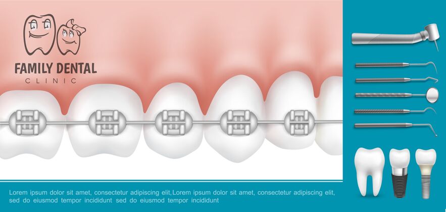 植入物真实的牙科和口腔医学组成与金属支架上的牙齿口腔医疗器械和牙科植入物牙科仪器金属